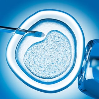 IVF